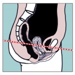 kegel exercises prevent the collapse of the pelvic floor