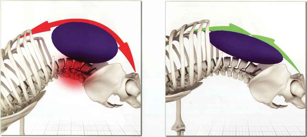 Back Pain Coming from Abs Rectus Abdominis