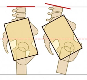 The psoas major, the rhomboids and your tucked pelvis have a intergral relationship