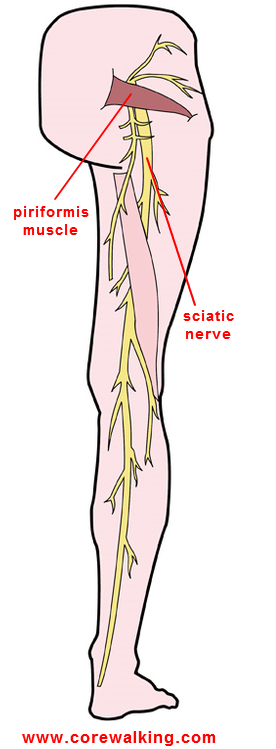 sciatica and piriformis