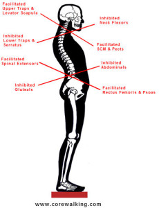 upper cross syndrome