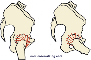 femoral head