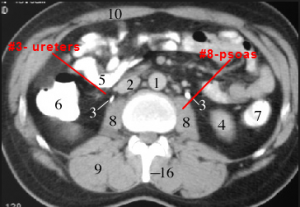 the psoas