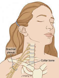 Brachial_plexus