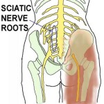 sciatic nerve and numbness in the foot