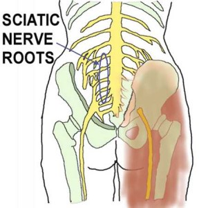 sciatic nerve and numbness in the foot