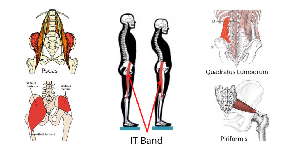 IT Band Problems: Why Does My Hip Hurt So Much?