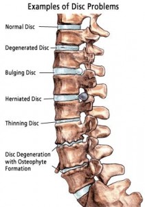 The lumbar curve of the spine