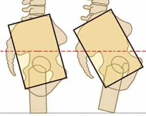 The lumbosacral joint