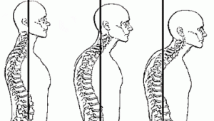 forward head posture and breathing