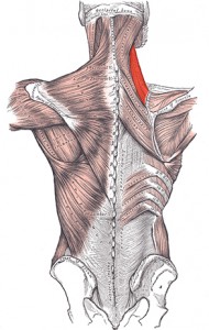 Upper cross syndrome 