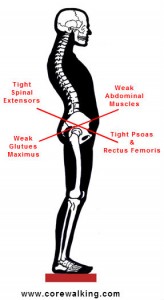 lower crossed syndrome