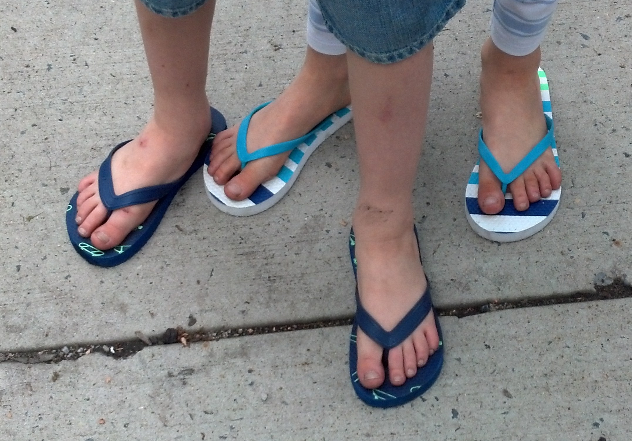 The Annual Flip Flops Are Bad For You Post.