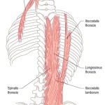 psoas erector spinea lower back pain