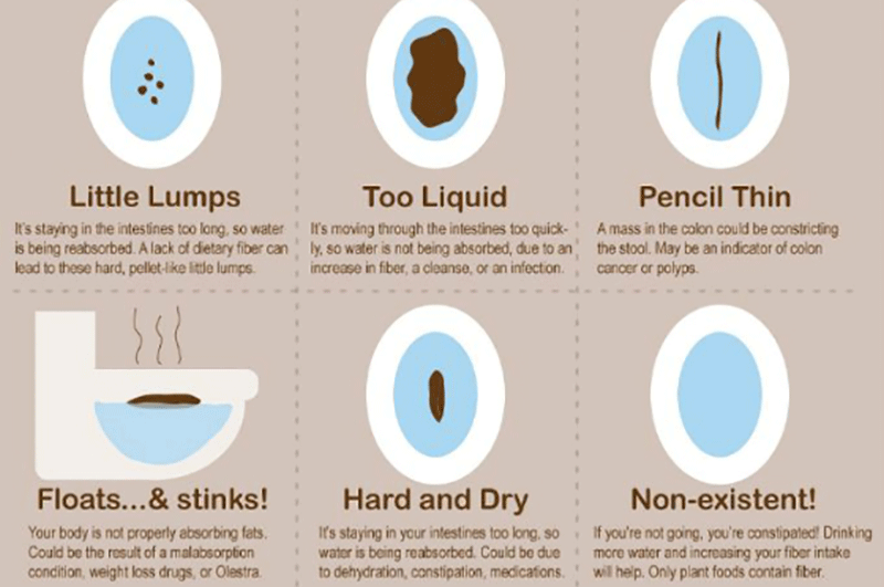 Unhealthy Human Poop