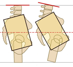 two pelvis side view