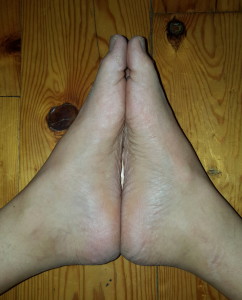 arches of my feet